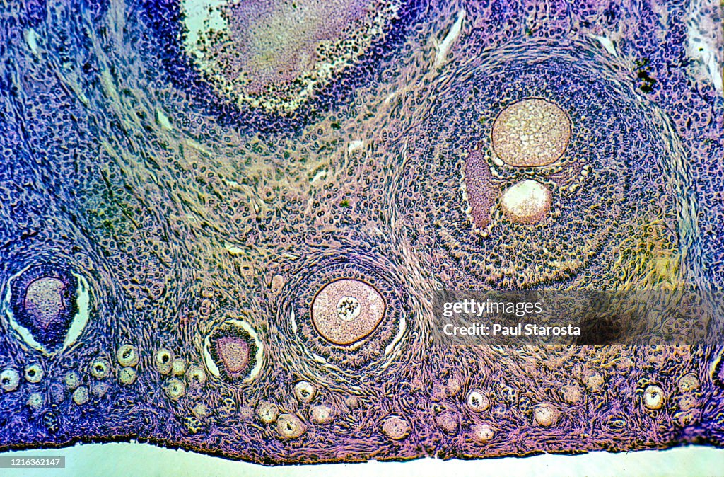 Ovarian follicles at different stages in a rabbit ovary