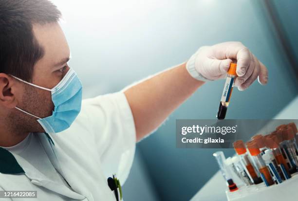coronavirus blood sample. - medical laboratory stock pictures, royalty-free photos & images