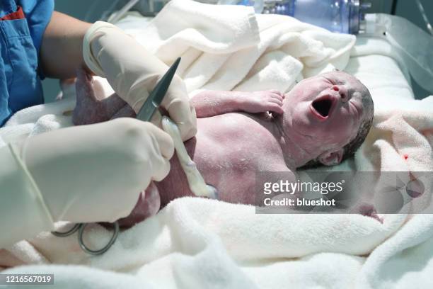 手術室中的新生兒 - umbilical cord 個照片及圖片檔