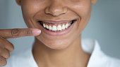 Closeup african woman point finger at perfect white toothy smile