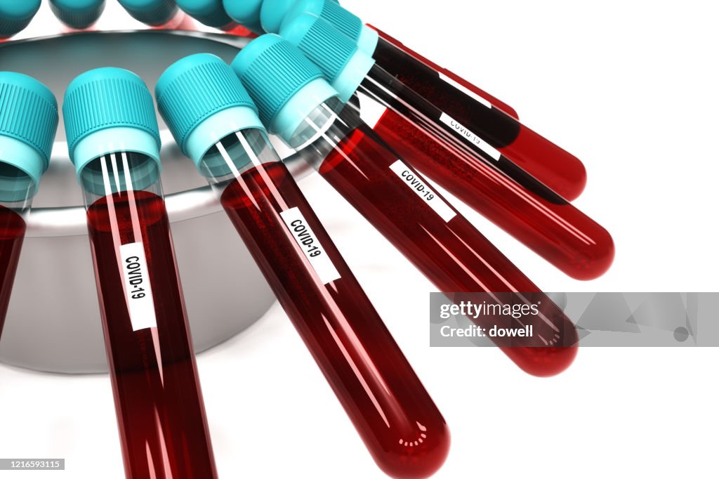 Vials of blood in a centrifuge,3D RENDER