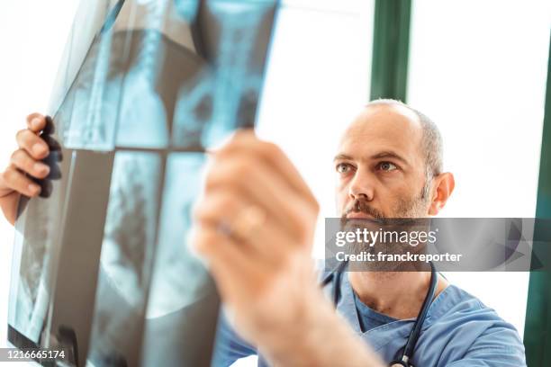 arts die de xray van longontsteking in het ziekenhuis controleert - lung cancer stockfoto's en -beelden