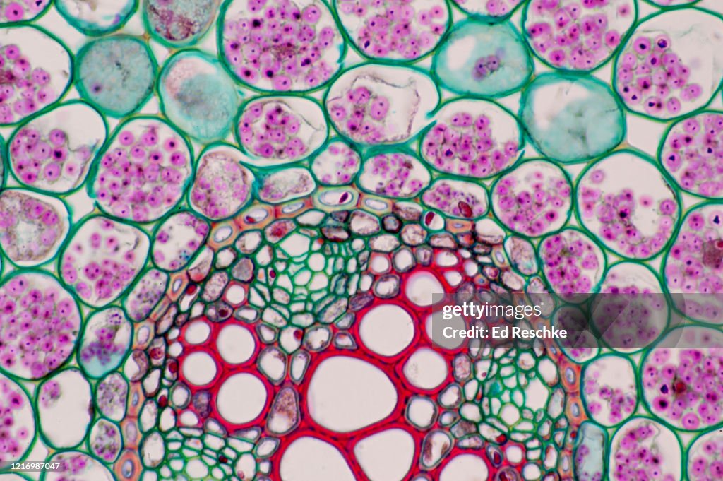 MICROANATOMY of a ROOT---IMPORTANT TISSUES: XYLEM, PHLOEM and PARENCHYMA, Buttercup Root Cross Section, 100X