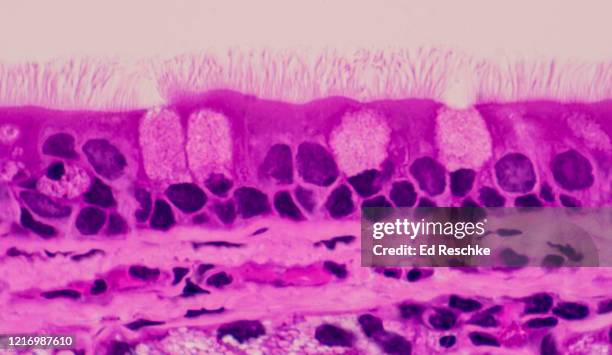 ciliated epithelium and goblet cells---pseudostratified ciliated columnar epithelium, trachea, 250x - menselijke luchtpijp stockfoto's en -beelden