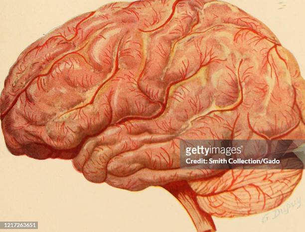 Illustration from the book "The Diseases of Infancy and Childhood" by Henry Koplik, showing a lateral view of the brain in epidemic cerebrospinal...