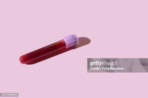 covid-19 test tube on the pink background - bloed stockfoto's en -beelden