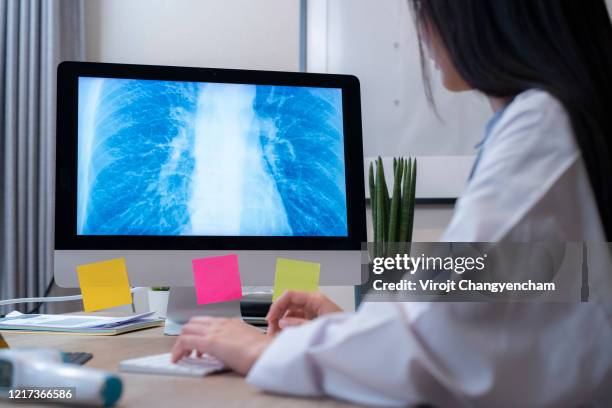 female doctor looking at chest x ray film on computer desktop at office hospital - tuberculosis stock pictures, royalty-free photos & images