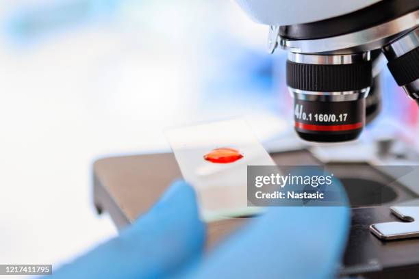 labortechniker, der blutprobe am mikroskop untersucht - blut stock-fotos und bilder