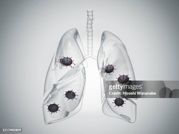 virus infected crystal lung, conceptual still life - crystal glasses stockfoto's en -beelden
