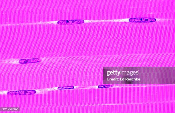 skeletal muscle fibres (or cells) in longitudinal section, 100x.  shows:  several muscle fibres or cells, striations, peripheral multinucleate nature of skeletal muscle cells, a bands, i bands, z lines, and endomysium. - muscle cell stock pictures, royalty-free photos & images