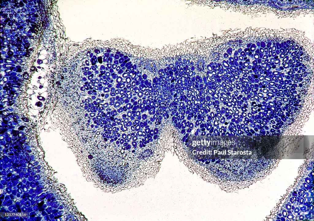 Alfalfa (Medicago sativa) root nodosity cross section
