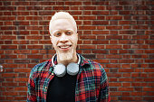 Portrait of handsome albino African man