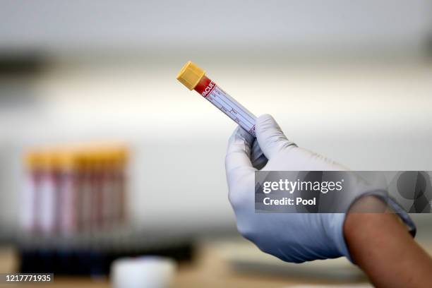 Paramedic holds a test tube containing a blood sample at an antibody testing program at the Hollymore Ambulance Hub of the West Midlands Ambulance...