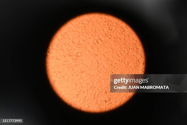 Microscope view of HEK 293T cells derived from human embryonic kidney used for SARS CoV 2 protein expression at INCUINTA laboratory at INTA Castelar...