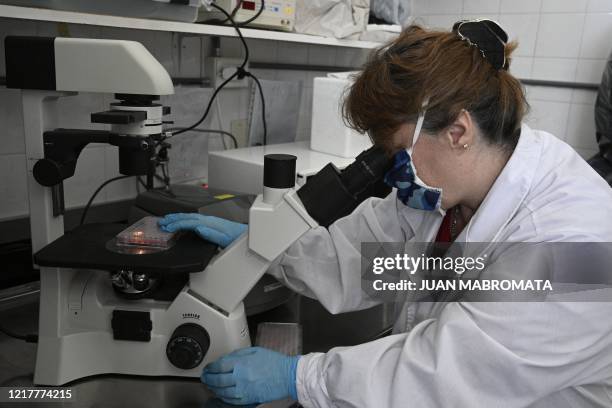 Argentine Dr. Viviana Parreno, biochemistry researcher of the INTA and CONICET , uses a microscope to look at HEK 293T cells derived from human...