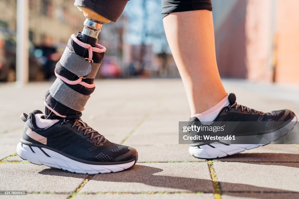 Close-up of legs of sporty woman with leg prosthesis in the city