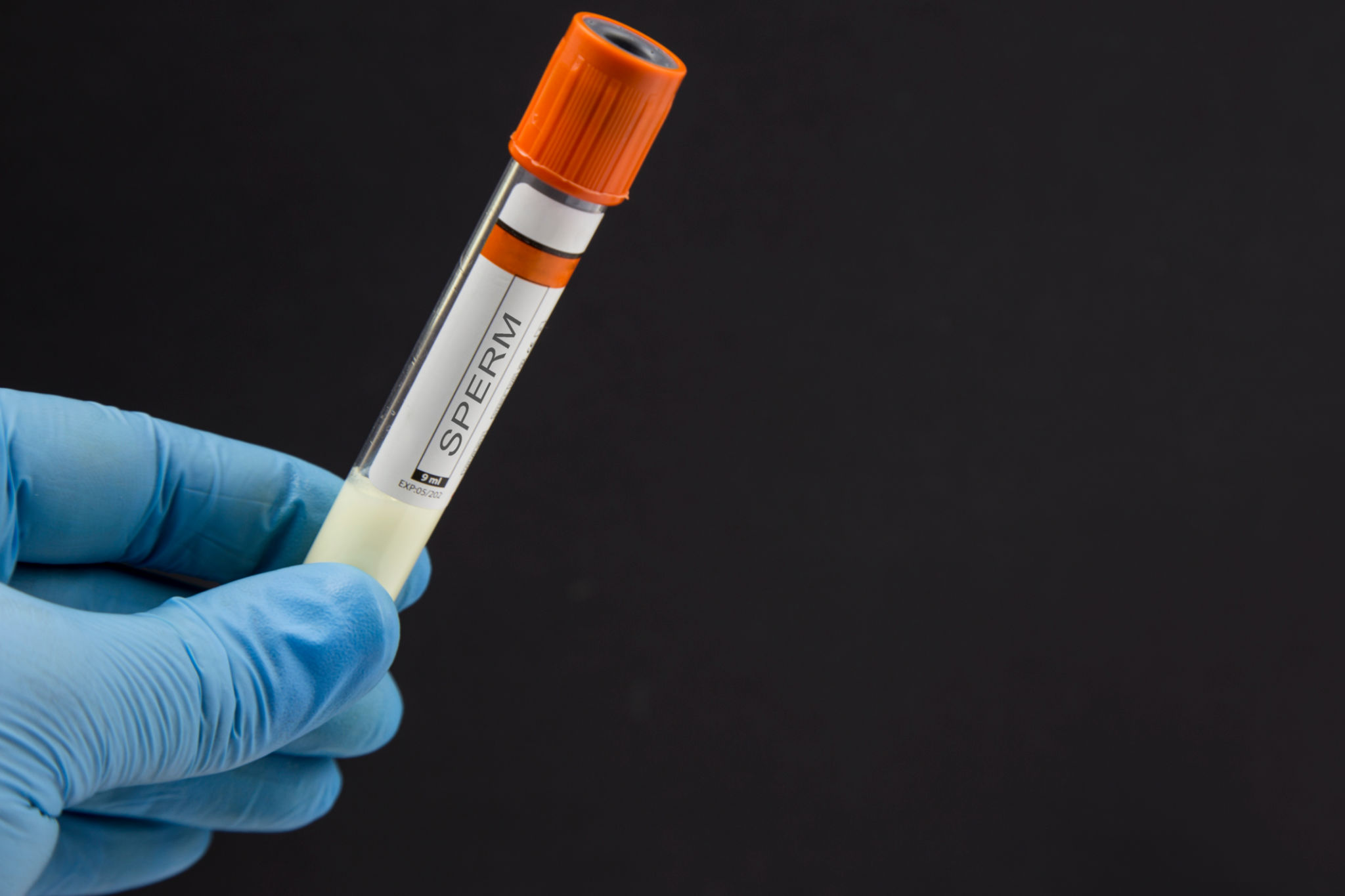 home sperm test kit