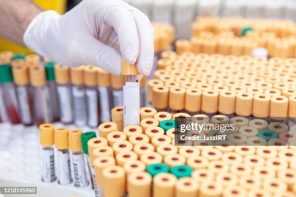 scientifique manipulant des tubes d’essai en laboratoire, covid-19 - blood testing photos et images de collection