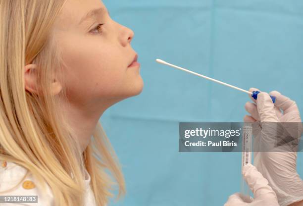 nasopharyngeal swab procedure, novel coronavirus (2019-ncov), coronavirus, covid-19 - coronavirus romania stock pictures, royalty-free photos & images