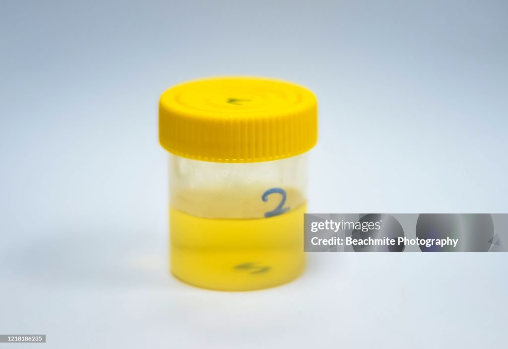 Urine Sample Container