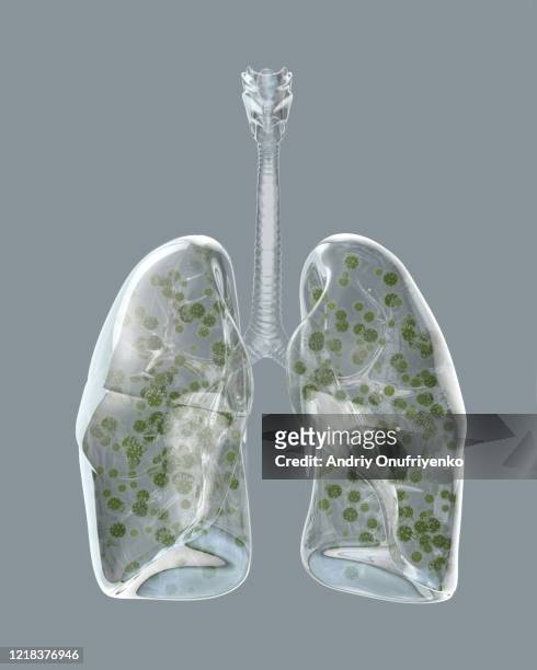 Glass lungs infected by coronavirus