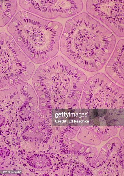villi in cross and longitudinal section with simple columnar epithelium-- small intestine, ileum 50x - simple columnar epithelial cell stock pictures, royalty-free photos & images