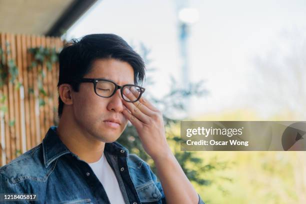 young man rubbing eye with hand - bloodshot fotografías e imágenes de stock