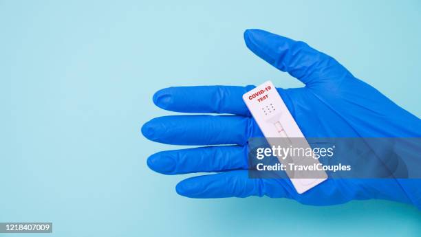 Testing Lab Card Blood Test Card Foto e immagini stock - Getty Images