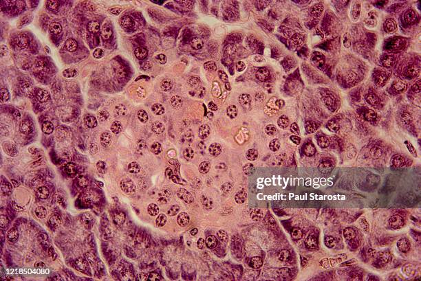 islet of langerhans - guinea pig pancreas - acinus cell stock pictures, royalty-free photos & images