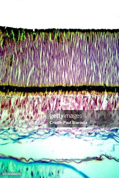Octopus Microscope Retina Microscope Photos and Premium High Res Pictures - Getty Images