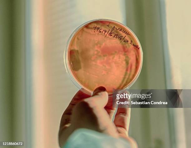 germs growing on an agar plate in laboratory, sars-cov-2 detection, test coronavirus covid-19, microbiological analysis. - listeriosis stock pictures, royalty-free photos & images