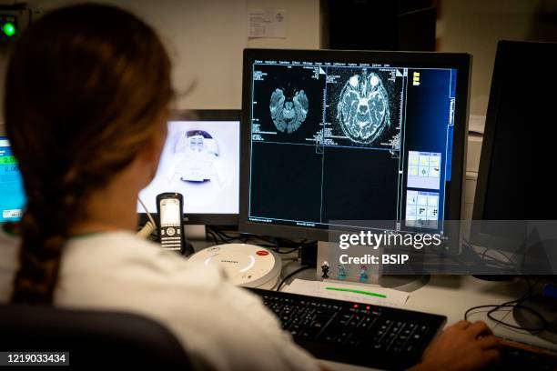 Year-old patient with signs of stroke is treated. Following the MRI, the neurologist hesitates on the procedure to follow and consults his colleague.