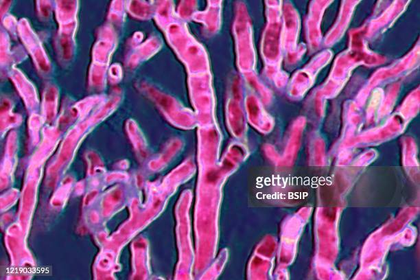 Aspergillus fumigatus, fungus responsible for severe infections as aspergilloma, disease in humans and birds such as bronchopulmonary aspergillosis...