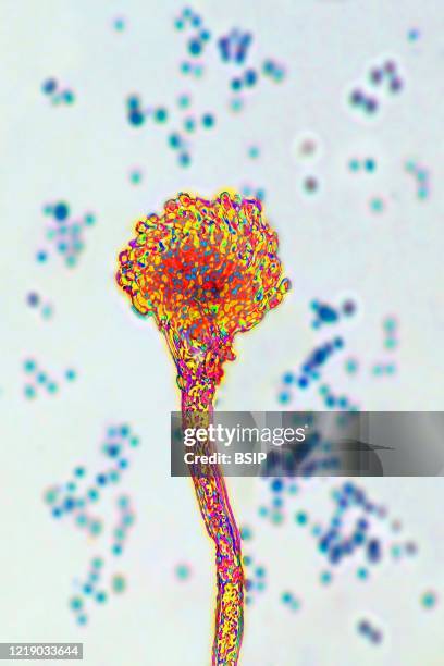 Aspergillus fumigatus, fungus responsible for severe infections as aspergilloma, disease in humans and birds such as bronchopulmonary aspergillosis...