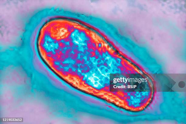 Bacterium brucella canis causes brucellosis in dogs and humans. This bacteria is of the family of brucellaceae. Optical microscope view.