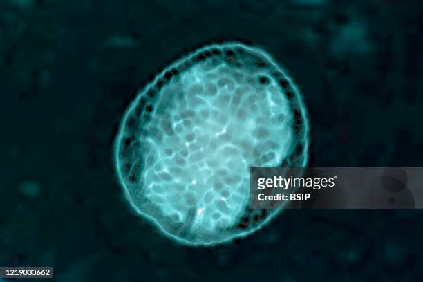Brucella bacterium responsible for brucellosis or Malta fever. Optical microscope view.
