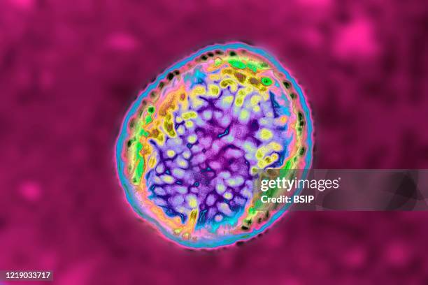 Brucella bacterium responsible for brucellosis or Malta fever. Optical microscope view.