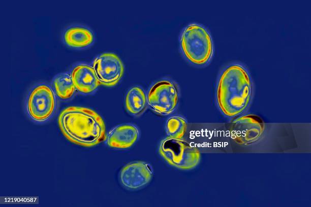 Candida auris is a yeast responsible for many infections. Resistant to most antifungal drugs, this fungus causes several deaths worldwide. Optical...