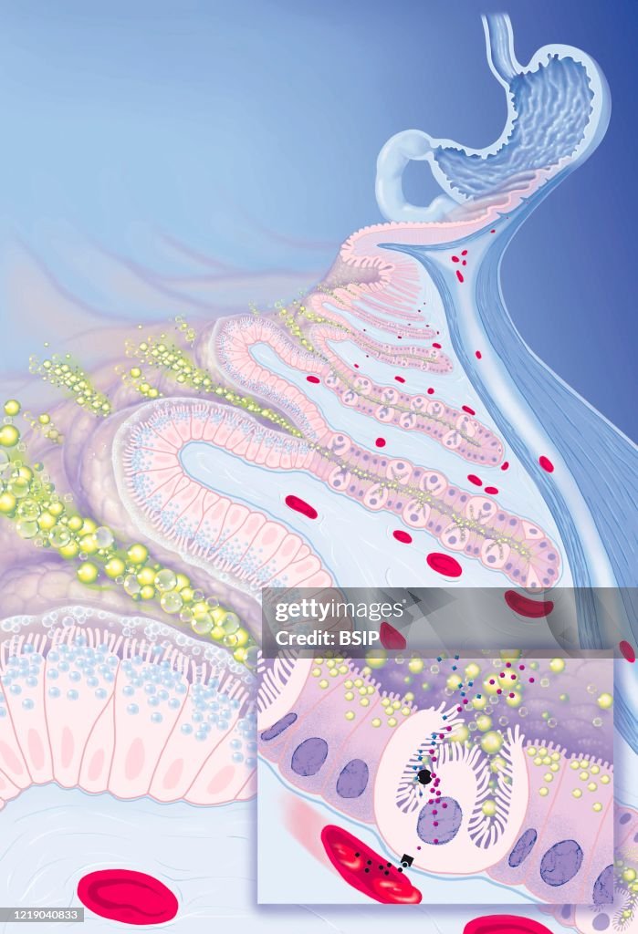 GASTRO-OESOPHAGEAL REFLUX