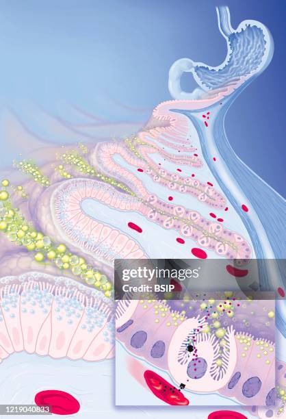 Site of action of gastro-oesophageal reflux treatments. Top a stomach with the esophagus and duodenum seen in section. Zoom a section of the gastric...