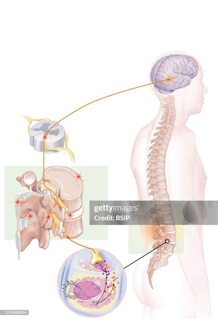 LOW BACK PAIN