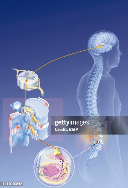 Brain and spine, lumbar nociceptors, nerve impulses, treatment. Anatomical situation of lumbago on a silhouette. On the left, details of the path of...