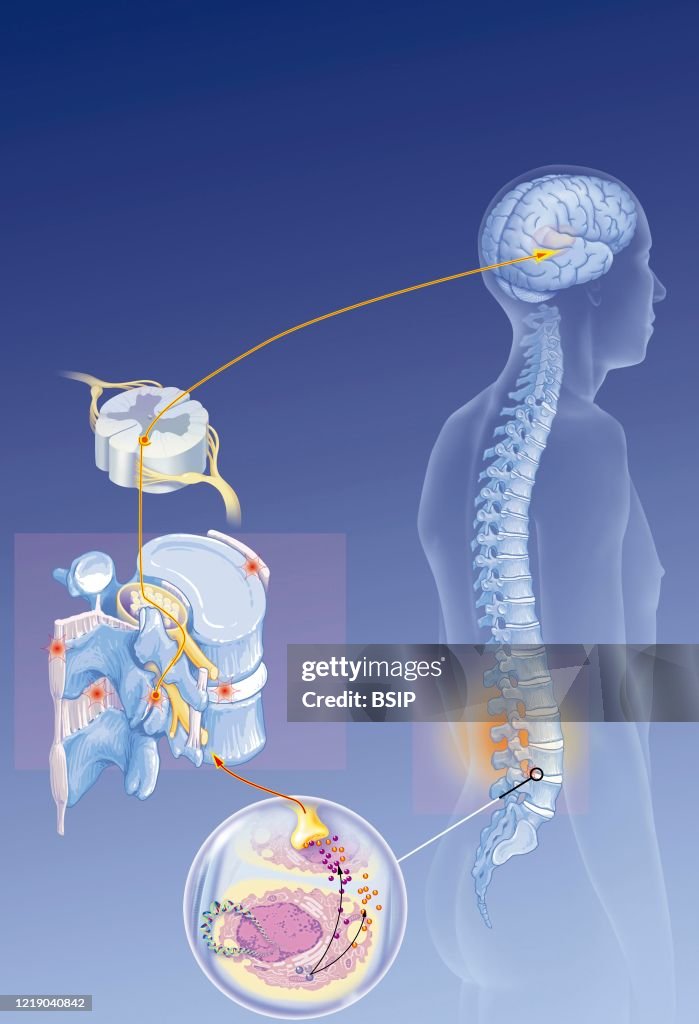 LOW BACK PAIN