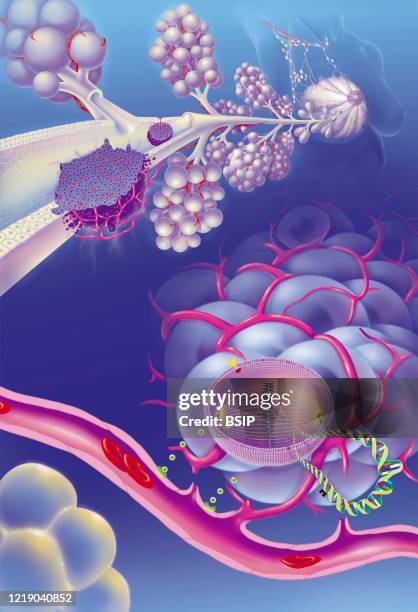 Infiltrating and in situ ductal adenocarcinomas, mitotic spindle zoom, treatments. Bust of a woman with a mammary gland and the axillary lymph nodes...
