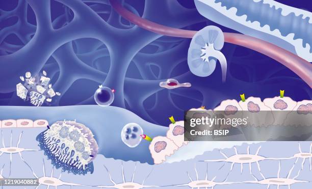 Cancellous bone, view of bone trabeculae of spongy bone . Osteoclasts destroy the bone, while osteoblasts make bone. Estrogen binds to the estrogen...