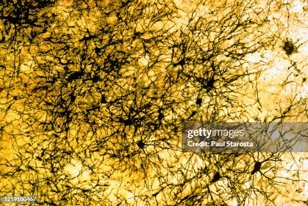 Cortex Microscope Brain Neuron Microscope Photos and Premium High Res Pictures - Getty Images