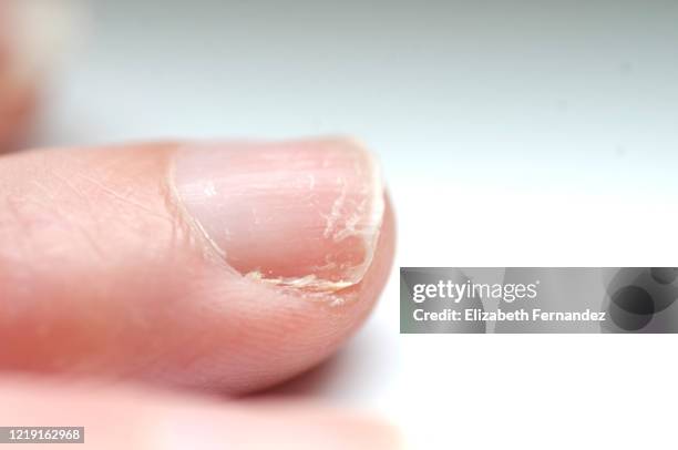 dry nails. - cutícula fotografías e imágenes de stock