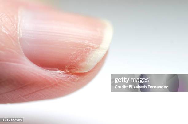 dry nails. - cutícula fotografías e imágenes de stock