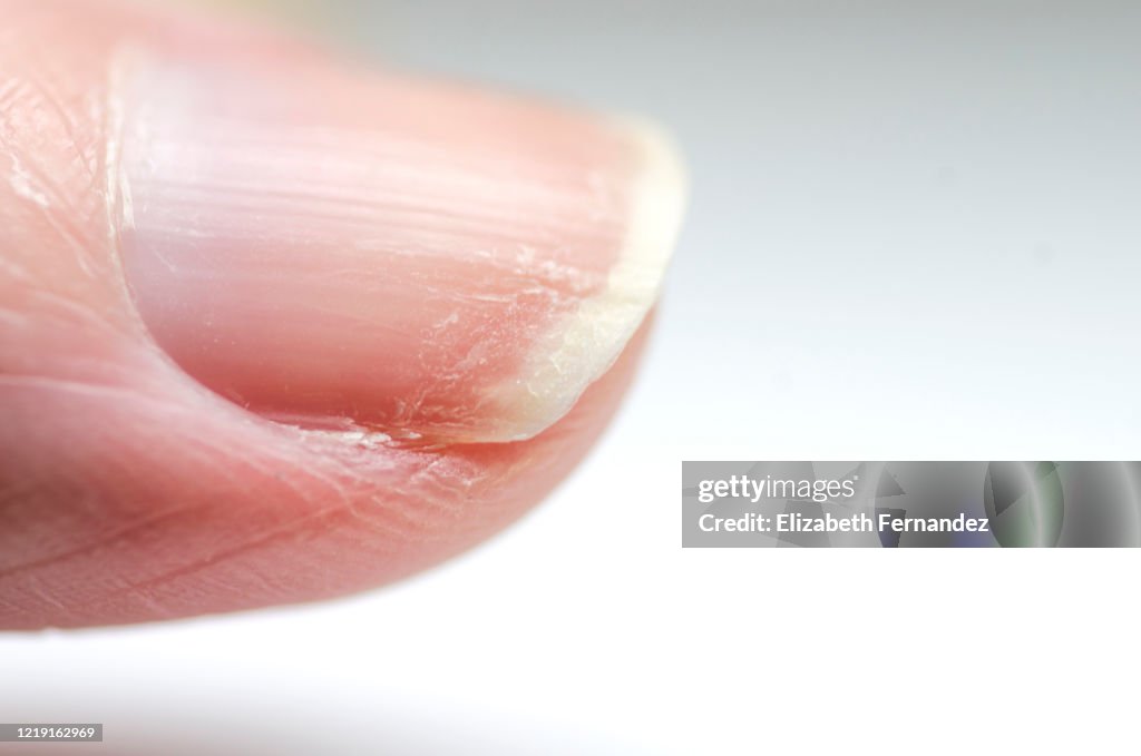 Dry nails.
