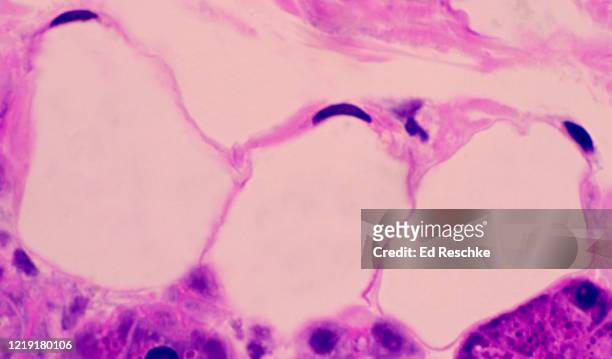 three fat cells (adipose tissue), parotid salivary gland, 100x - fettgewebezelle stock-fotos und bilder